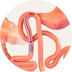 The magnets leaving the body naturally