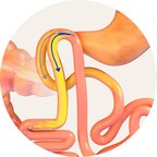 Food taking a shorter route through the gut
